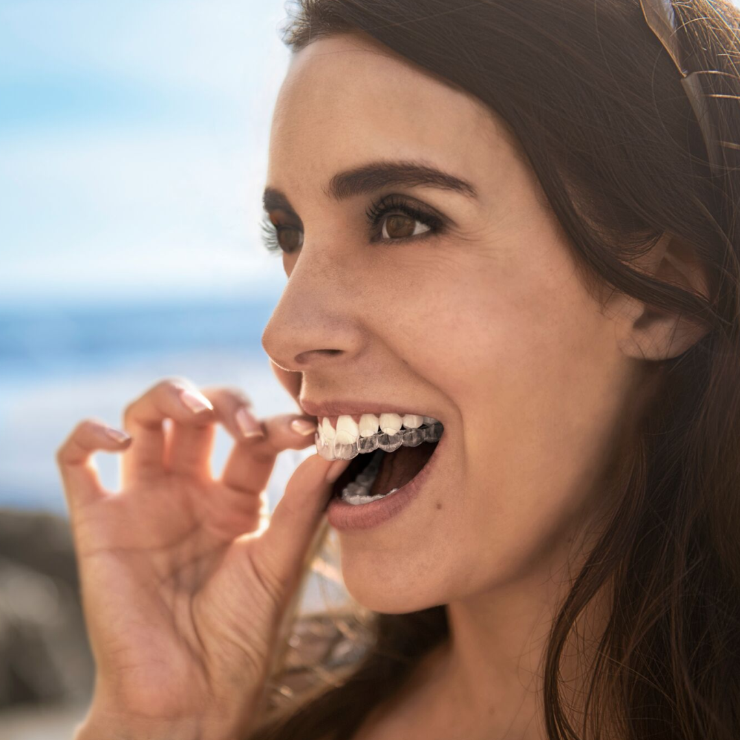 Invisalign – José Nelson Grimaldi Odontologia – Clínica Odontológica  Especializada em Estética Oral – Meia Praia Itapema Santa Catarina