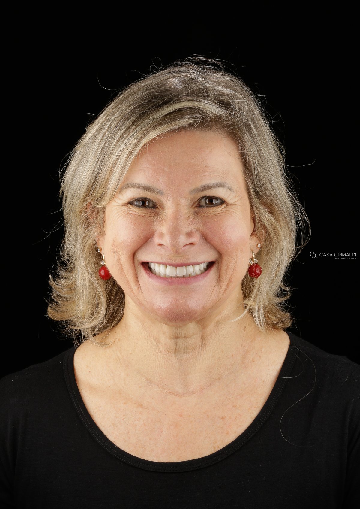 Reabilitação oral em Itapema — sorriso completamente restaurado